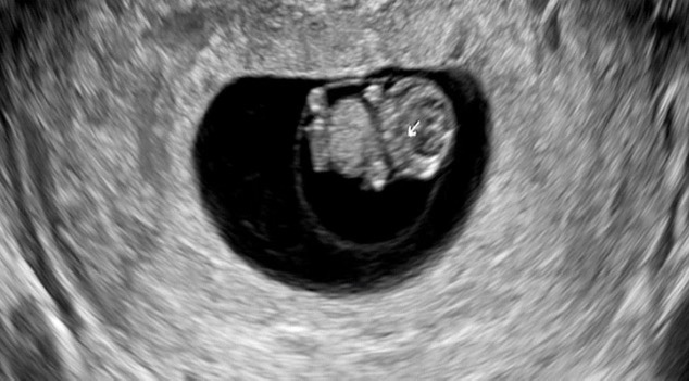 [변호사인데요, 임출육합니다] 2. 가장 완벽한 자녀계획은? 무계획이다.